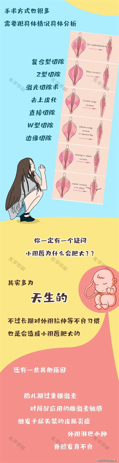 女人小穴|原来女性私处还有这么多型？这种形状一定要当心！丨医学图解